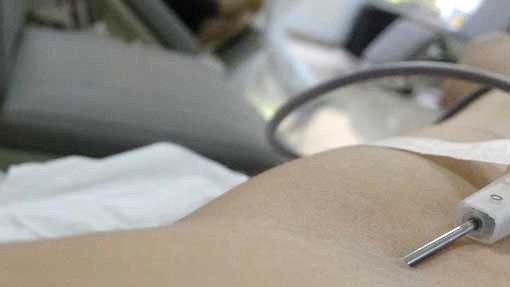 donazione sangue